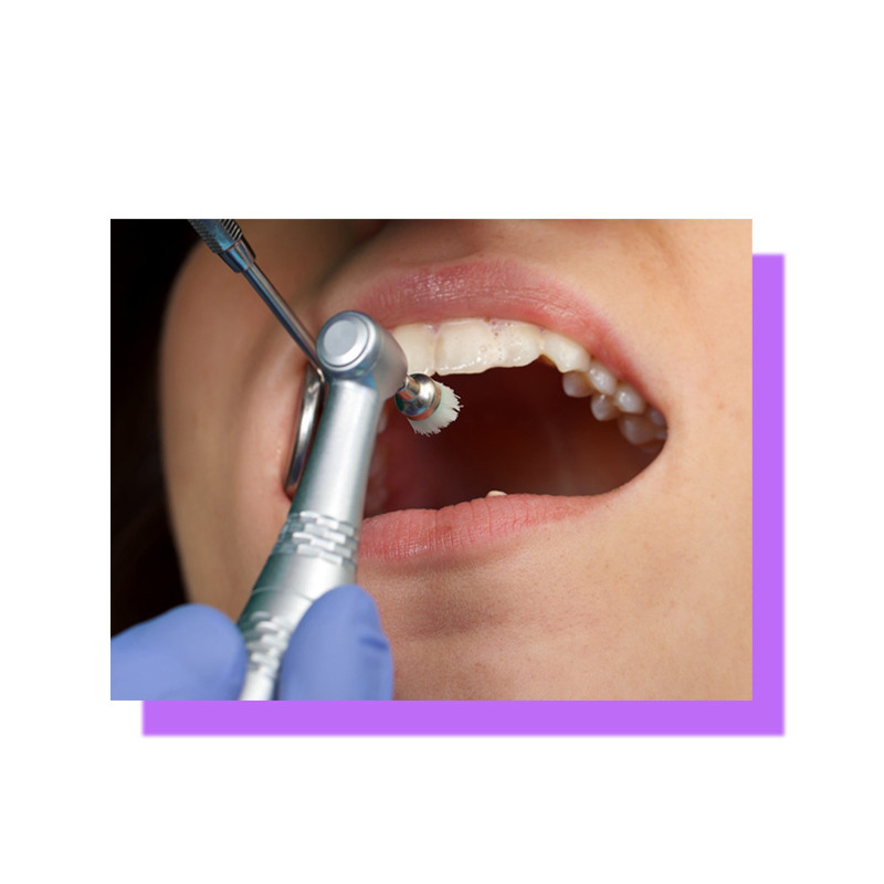 Oral Prophylaxis Starts at P800